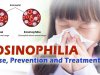 Eosinophilia