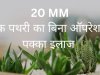 किड्नी स्टोन