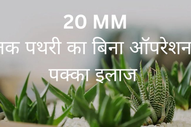 किड्नी स्टोन